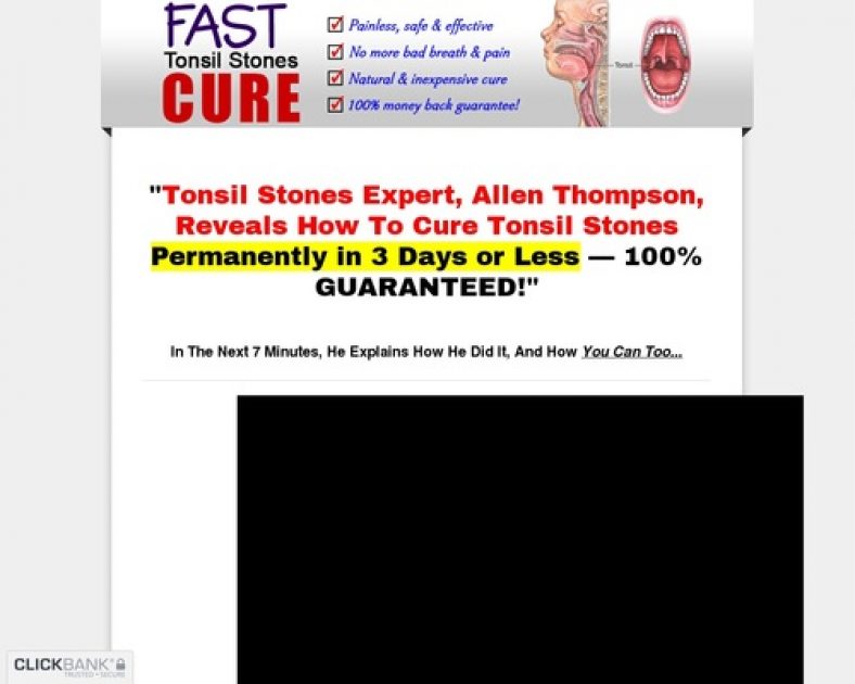 How To Cure Tonsil Stones - How to Cure Tonsil Stones